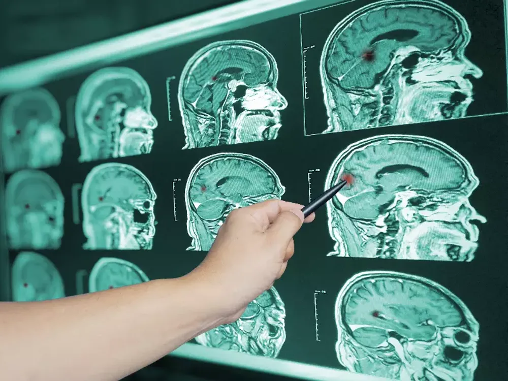 Northern Roots Family Spinal Care treating post-concussion recovery in Clear Lake